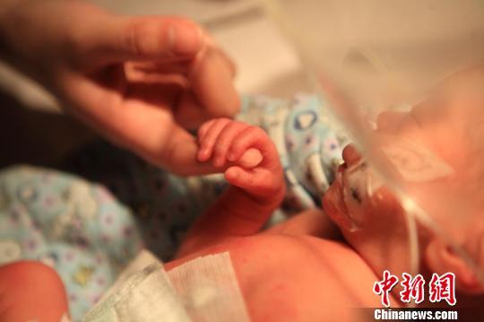 Shanghai : le prématuré né 12 semaines avant terme va pouvoir rentrer chez lui