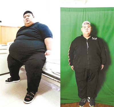 Le « Chinois le plus gros » perd 140 kg 