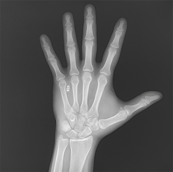 Une puce implantée dans la main réussit un paiement par un simple geste