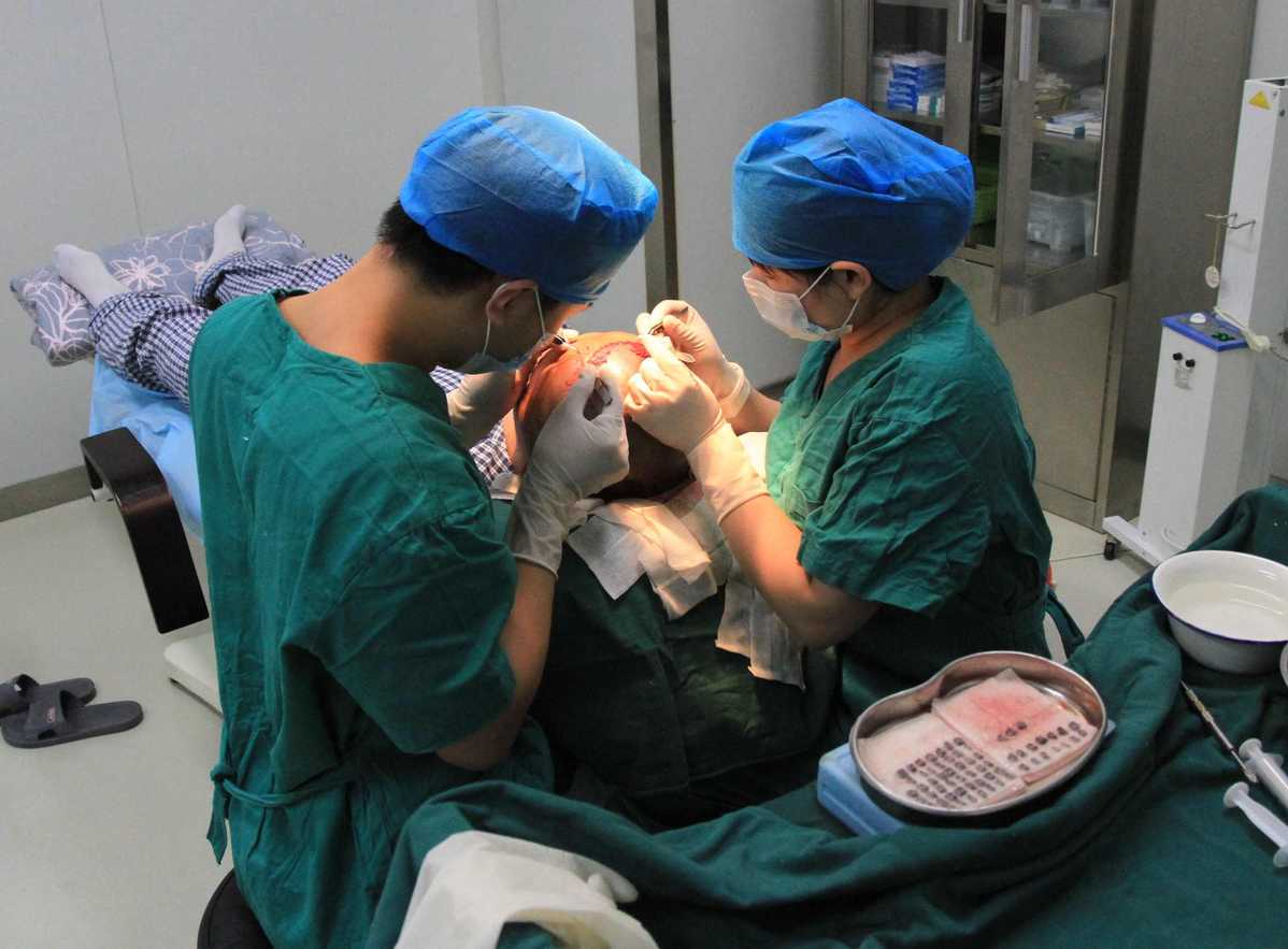 Les médecins effectuent une opération de greffe de cheveux dans un établissement du groupe médical Yonghe à Pékin. (China News Service / Pan Xulin)