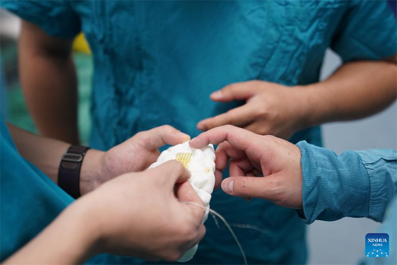 Des médecins discutent des détails de l'implantation d'électrodes corticales lors d'une opération chirurgicale de l'interface cerveau-ordinateur à Nanchang, capitale de la province du Jiangxi (est de la Chine), le 21 décembre 2025. (Zhou Mi/Xinhua)